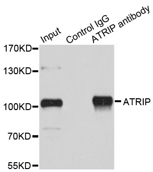 ATRIP Antibody - Immunoprecipitation analysis of 200ug extracts of HeLa cells.