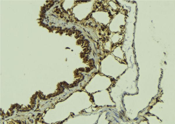 ATRIP Antibody - 1:100 staining mouse lung tissue by IHC-P. The sample was formaldehyde fixed and a heat mediated antigen retrieval step in citrate buffer was performed. The sample was then blocked and incubated with the antibody for 1.5 hours at 22°C. An HRP conjugated goat anti-rabbit antibody was used as the secondary.