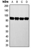 ATRIP Antibody - Western blot analysis of ATRIP expression in MCF7 (A); HeLa (B); NIH3T3 (C); rat liver (D) whole cell lysates.
