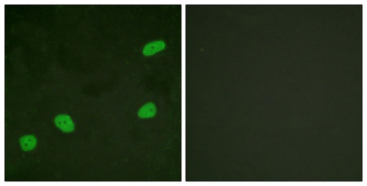 ATRIP Antibody - Peptide - + Immunofluorescence analysis of HeLa cells, using ATRIP (Ab-68/72) antibody.