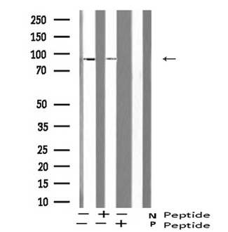 ATRIP Antibody - Western blot analysis of ATRIP (Phospho-Ser224) expression in human mammary cells lysate