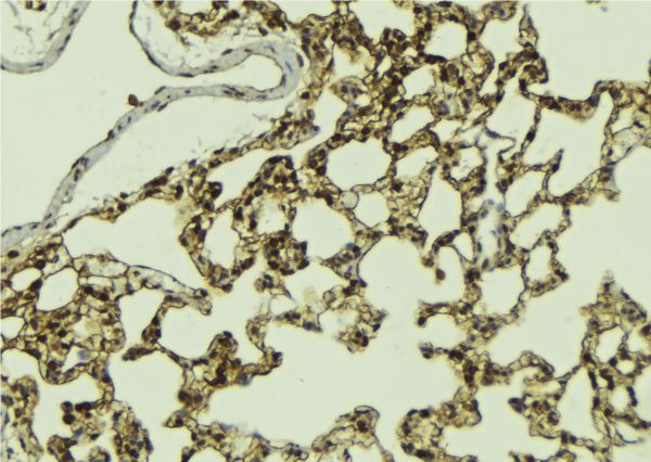 ATRIP Antibody - 1:100 staining mouse lung tissue by IHC-P. The sample was formaldehyde fixed and a heat mediated antigen retrieval step in citrate buffer was performed. The sample was then blocked and incubated with the antibody for 1.5 hours at 22°C. An HRP conjugated goat anti-rabbit antibody was used as the secondary.