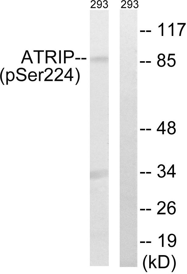 ATRIP Antibody - Western blot analysis of extracts from 292 cells, treated with UV (15mins), using ATRIP (Phospho-Ser224) antibody.