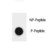 ATRIP Antibody - Dot blot of Phospho-ATRIP-S239 Antibody Phospho-specific antibody on nitrocellulose membrane. 50ng of Phospho-peptide or Non Phospho-peptide per dot were adsorbed. Antibody working concentrations are 0.6ug per ml.