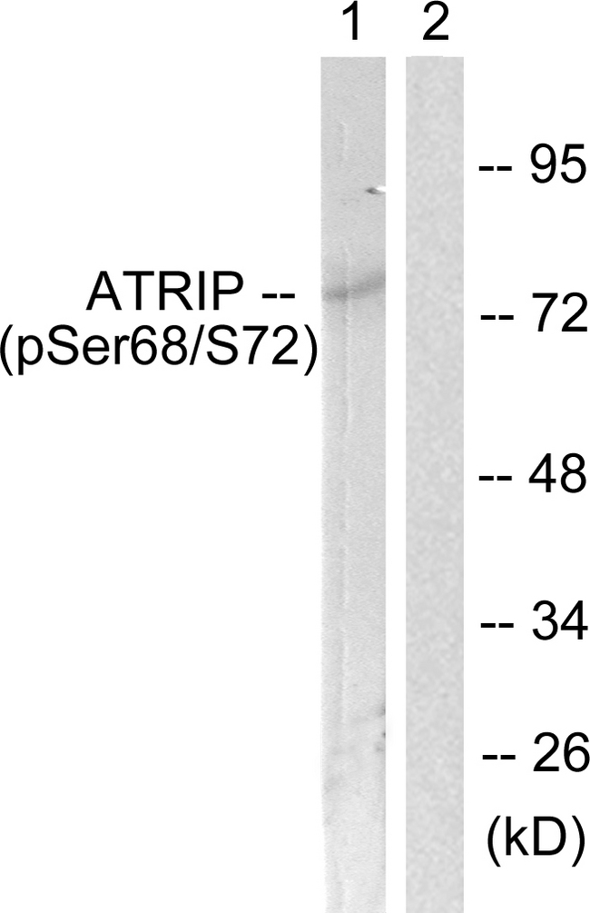 ATRIP Antibody - Western blot analysis of lysates from NIH/3T3 cells, using ATRIP (Phospho-Ser68) Antibody. The lane on the right is blocked with the phospho peptide.