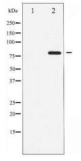 ATRIP Antibody - Western blot of ATRIP phosphorylation expression in NIH-3T3 whole cell lysates,The lane on the left is treated with the antigen-specific peptide.