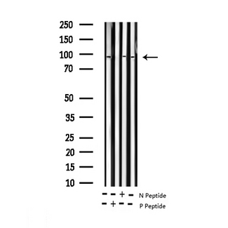 ATRIP Antibody - Western blot analysis of Phospho-ATRIP (Ser68) expression in various lysates