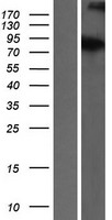 ATRIP Protein - Western validation with an anti-DDK antibody * L: Control HEK293 lysate R: Over-expression lysate