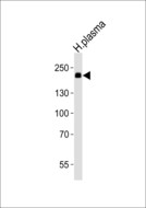 ATRN / Attractin Antibody - Western blot of lysate from human plasma tissue lysate with ATRN Antibody. Antibody was diluted at 1:1000. A goat anti-rabbit IgG H&L (HRP) at 1:10000 dilution was used as the secondary antibody. Lysate at 35 ug.