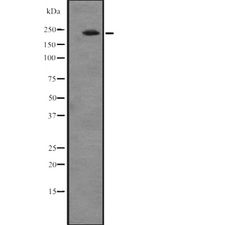 ATRN / Attractin Antibody - Western blot analysis of ATRN expression in A549 cells line lysates. The lane on the left is treated with the antigen-specific peptide.