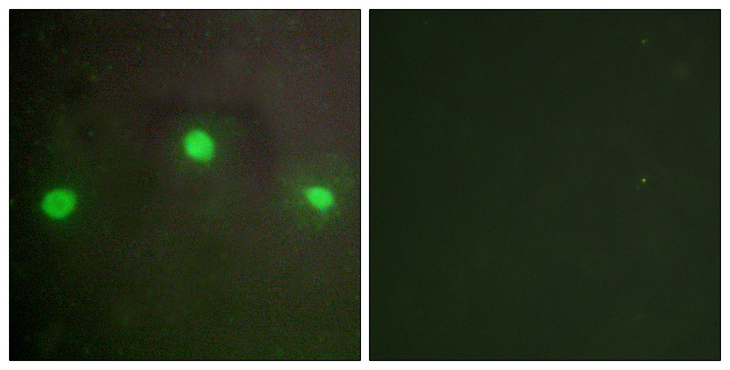 ATRX Antibody - Immunofluorescence analysis of A549 cells, using ATRX Antibody. The picture on the right is blocked with the synthesized peptide.