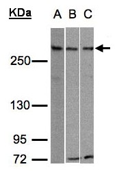 ATRX Antibody - Sample (30g whole cell lysate). A:293T, B: Hep G2 , C: Raji . 5% SDS PAGE. RAD54 / ATRX antibody diluted at 1:500