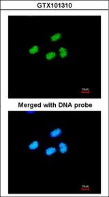 ATRX Antibody - Immunofluorescence of paraformaldehyde-fixed HeLa using ATRX antibody at 1:200 dilution.