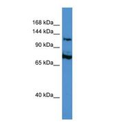 ATRX Antibody - Western blot of Human Jurkat. ATRX antibody dilution 1.0 ug/ml.  This image was taken for the unconjugated form of this product. Other forms have not been tested.