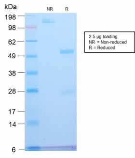 ATRX Antibody - SDS-PAGE Analysis Purified ATRX Rabbit Recombinant Monoclonal Antibody (ATRX/2900R). Confirmation of Purity and Integrity of Antibody.