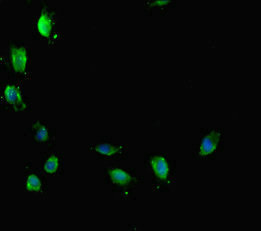 ATRX Antibody - Immunofluorescent analysis of Hela cells diluted at 1:100 and Alexa Fluor 488-congugated AffiniPure Goat Anti-Rabbit IgG(H+L)