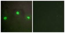 ATRX Antibody - Peptide - + Immunofluorescence analysis of A549 cells, using ATRX antibody.