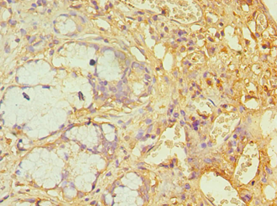 ATXN1 / SCA1 Antibody - Immunohistochemistry of paraffin-embedded human gallbladder using antibody at 1:100 dilution.