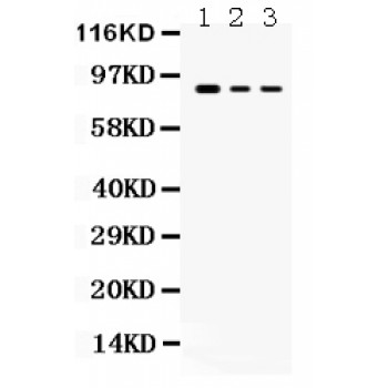 ATXN1 / SCA1 Antibody - Ataxin 1 antibody Western blot. All lanes: Anti Ataxin 1 at 0.5 ug/ml. Lane 1: MCF-7 Whole Cell Lysate at 40 ug. Lane 2: COLO320 Whole Cell Lysate at 40 ug. Lane 3: PANC Whole Cell Lysate at 40 ug. Predicted band size: 87 kD. Observed band size: 87 kD.