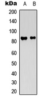 ATXN1 / SCA1 Antibody - Western blot analysis of Ataxin 1 expression in U251 (A); mouse brain (B) whole cell lysates.