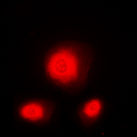 ATXN1 / SCA1 Antibody - Immunofluorescent analysis of Ataxin 1 staining in U251 cells. Formalin-fixed cells were permeabilized with 0.1% Triton X-100 in TBS for 5-10 minutes and blocked with 3% BSA-PBS for 30 minutes at room temperature. Cells were probed with the primary antibody in 3% BSA-PBS and incubated overnight at 4 ??C in a humidified chamber. Cells were washed with PBST and incubated with a DyLight 594-conjugated secondary antibody (red) in PBS at room temperature in the dark. DAPI was used to stain the cell nuclei (blue).