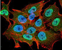 ATXN1 / SCA1 Antibody - Detection of Ataxin-1 in Neuroblastoma cell line SK-N-BE with Ataxin-1 Monoclonal Antibody at 10ug/ml: DAPI (blue) nuclear stain, Texas Red F actin stain, FITC (green) Ataxin-1 stain.