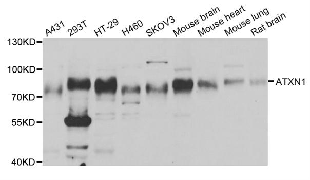 ATXN1 / SCA1 Antibody - Western blot analysis of extracts of various cell lines, using ATXN1 antibody.