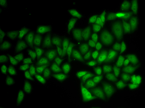 ATXN1 / SCA1 Antibody - Immunofluorescence analysis of HeLa cells.