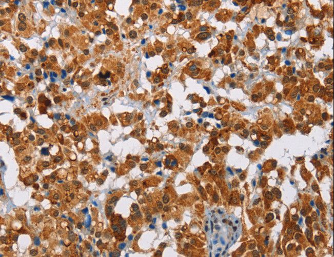 ATXN1 / SCA1 Antibody - Immunohistochemistry of paraffin-embedded Human brain using ATXN1 Polyclonal Antibody at dilution of 1:40.