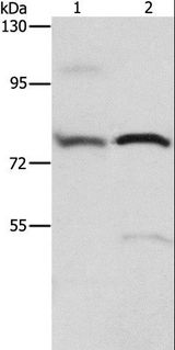 ATXN1 / SCA1 Antibody - Western blot analysis of 293T cell and human fetal brain tissue, using ATXN1 Polyclonal Antibody at dilution of 1:800.
