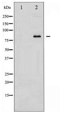 ATXN1 / SCA1 Antibody - Western blot of Ataxin 1 expression in NIH-3T3 whole cell lysates,The lane on the left is treated with the antigen-specific peptide.