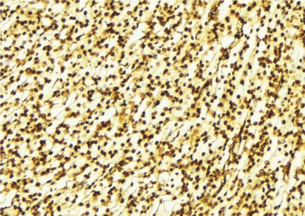 ATXN1 / SCA1 Antibody - 1:100 staining human gastric tissue by IHC-P. The sample was formaldehyde fixed and a heat mediated antigen retrieval step in citrate buffer was performed. The sample was then blocked and incubated with the antibody for 1.5 hours at 22°C. An HRP conjugated goat anti-rabbit antibody was used as the secondary.