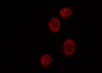 ATXN1 / SCA1 Antibody - Staining HepG2 cells by IF/ICC. The samples were fixed with PFA and permeabilized in 0.1% Triton X-100, then blocked in 10% serum for 45 min at 25°C. The primary antibody was diluted at 1:200 and incubated with the sample for 1 hour at 37°C. An Alexa Fluor 594 conjugated goat anti-rabbit IgG (H+L) Ab, diluted at 1/600, was used as the secondary antibody.