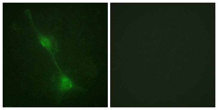 ATXN1 / SCA1 Antibody - Peptide - + Immunofluorescence analysis of 3T3 cells, using Ataxin 1 antibody.