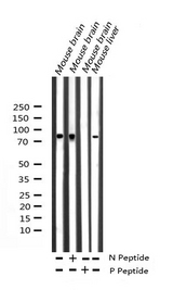 ATXN1 / SCA1 Antibody - Western blot analysis of Phospho-Ataxin 1 (Ser775) expression in various lysates