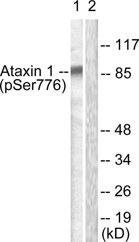 ATXN1 / SCA1 Antibody - Western blot analysis of extracts from HepG2 cells, treated with Adriamycin (0.5uM, 5hours), using Ataxin 1 (Phospho-Ser776) antibody.