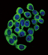 ATXN1 / SCA1 Antibody - Confocal immunofluorescence of ATXN1 Antibody (S776) with HeLa cell followed by Alexa Fluor 488-conjugated goat anti-rabbit lgG (green). DAPI was used to stain the cell nuclear (blue).