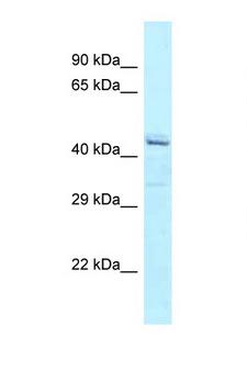 ATXN10 / SCA10 Antibody - ATXN10 / Ataxin-10 antibody Western blot of ACHN Cell lysate. Antibody concentration 1 ug/ml.  This image was taken for the unconjugated form of this product. Other forms have not been tested.
