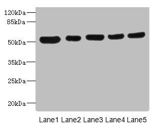 ATXN10 / SCA10 Antibody - Western blot All Lanes: ATXN10 antibody at 4.79ug/ml Lane 1: A431 whole cell lysate Lane 2: LO2 whole cell lysate Lane 3: HepG-2 whole cell lysate Lane 4: 293T whole cell lysate Lane 5: Hela whole cell lysate Secondary Goat polyclonal to rabbit IgG at 1/10000 dilution Predicted band size: 54,47 kDa Observed band size: 53 kDa