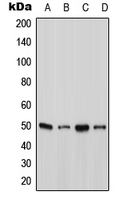 ATXN10 / SCA10 Antibody - Western blot analysis of Ataxin 10 expression in A431 (A); HepG2 (B); SP2/0 (C); H9C2 (D) whole cell lysates.