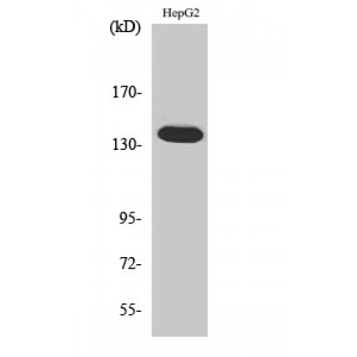 ATXN2 / SCA2 / Ataxin-2 Antibody - Western blot of Ataxin-2 antibody