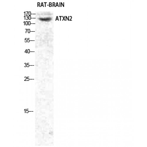 ATXN2 / SCA2 / Ataxin-2 Antibody - Western blot of Ataxin-2 antibody