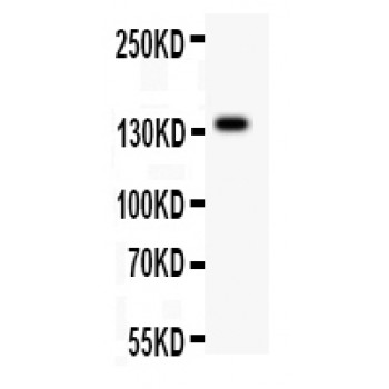 ATXN2 / SCA2 / Ataxin-2 Antibody - ATX2 antibody Western blot. All lanes: Anti ATX2 at 0.5 ug/ml. WB: Mouse Liver Tissue Lysate at 50 ug. Predicted band size: 140 kD. Observed band size: 140 kD.