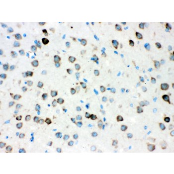 ATXN2 / SCA2 / Ataxin-2 Antibody - ATX2 antibody IHC-paraffin. IHC(P): Mouse Brain Tissue.