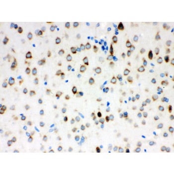 ATXN2 / SCA2 / Ataxin-2 Antibody - ATX2 antibody IHC-paraffin. IHC(P): Rat Brain Tissue.