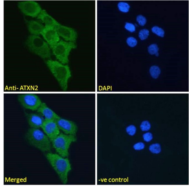 ATXN2 / SCA2 / Ataxin-2 Antibody - Goat Anti-ATXN2 Antibody Immunofluorescence analysis of paraformaldehyde fixed A431 cells, permeabilized with 0.15% Triton. Primary incubation 1hr (10ug/ml) followed by Alexa Fluor 488 secondary antibody (2ug/ml), showing cytoplasmic staining. The nuclear stain is DAPI (blue). Negative control: Unimmunized goat IgG (10ug/ml) followed by Alexa Fluor 488 secondary antibody (2ug/ml).