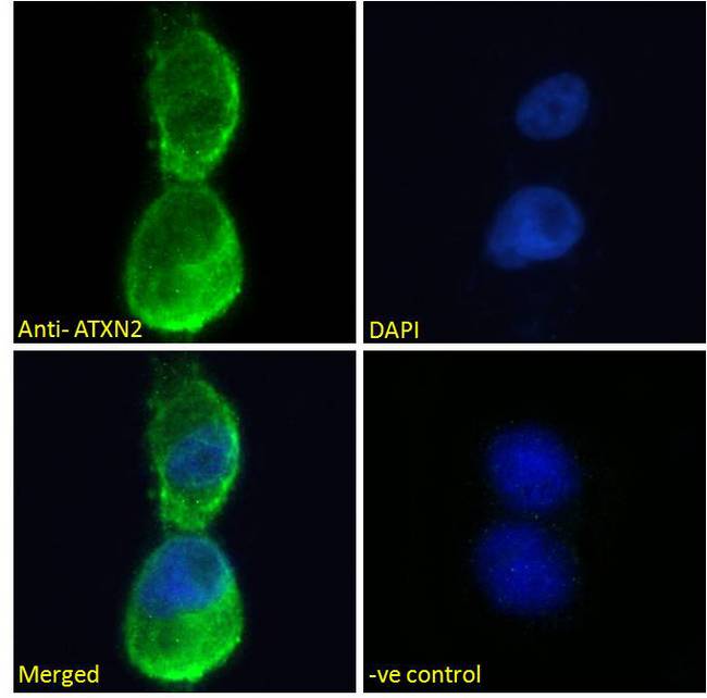 ATXN2 / SCA2 / Ataxin-2 Antibody - Goat Anti-ATXN2 Antibody Immunofluorescence analysis of paraformaldehyde fixed U2OS cells, permeabilized with 0.15% Triton. Primary incubation 1hr (10ug/ml) followed by Alexa Fluor 488 secondary antibody (2ug/ml), showing cytoplasmic staining. The nuclear stain is DAPI (blue). Negative control: Unimmunized goat IgG (10ug/ml) followed by Alexa Fluor 488 secondary antibody (2ug/ml).