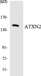 ATXN2 / SCA2 / Ataxin-2 Antibody - Western blot analysis of the lysates from HepG2 cells using ATXN2 antibody.