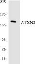 ATXN2 / SCA2 / Ataxin-2 Antibody - Western blot analysis of the lysates from HepG2 cells using ATXN2 antibody.
