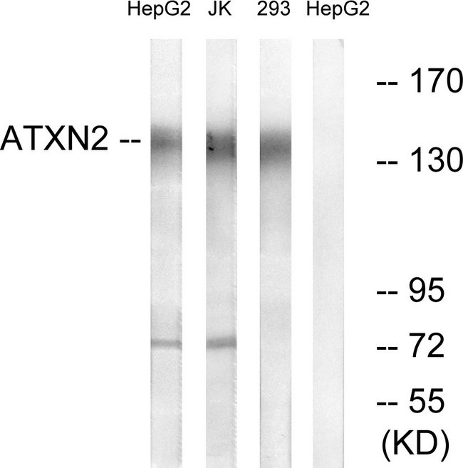 ATXN2 / SCA2 / Ataxin-2 Antibody - Western blot analysis of lysates from HepG2, Jurkat, and 293 cells, using ATXN2 Antibody. The lane on the right is blocked with the synthesized peptide.